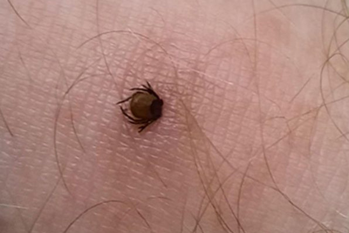 Укус клеща вызывает зуд и покраснение.