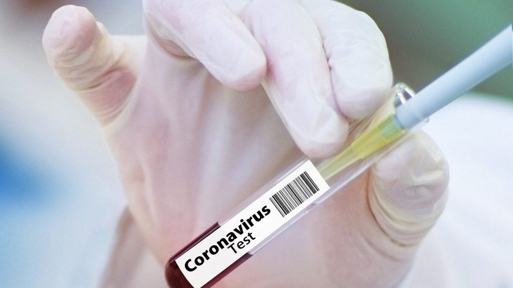 Британские ученые назвали новую опасность, которую несет SARS-CoV-2